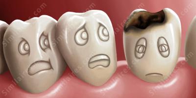 dents pourries films