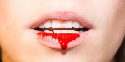 du sang sur la bouche films