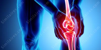 arthrite films