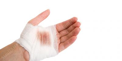 blessure à la main films