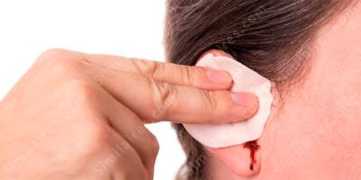 saignement des oreilles films